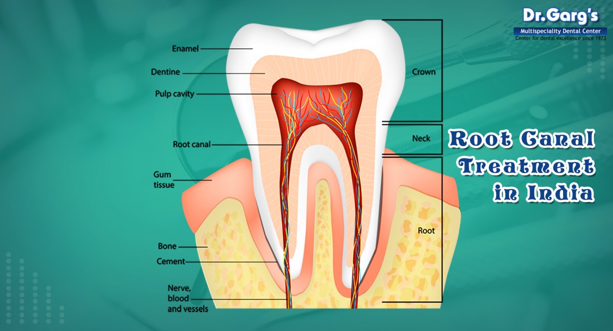 Dr. Garg’s Dental Centre