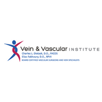 varicose and spider vein treatment