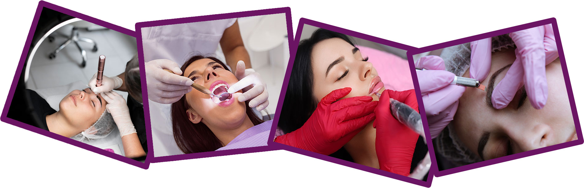 Teeth Whitening service