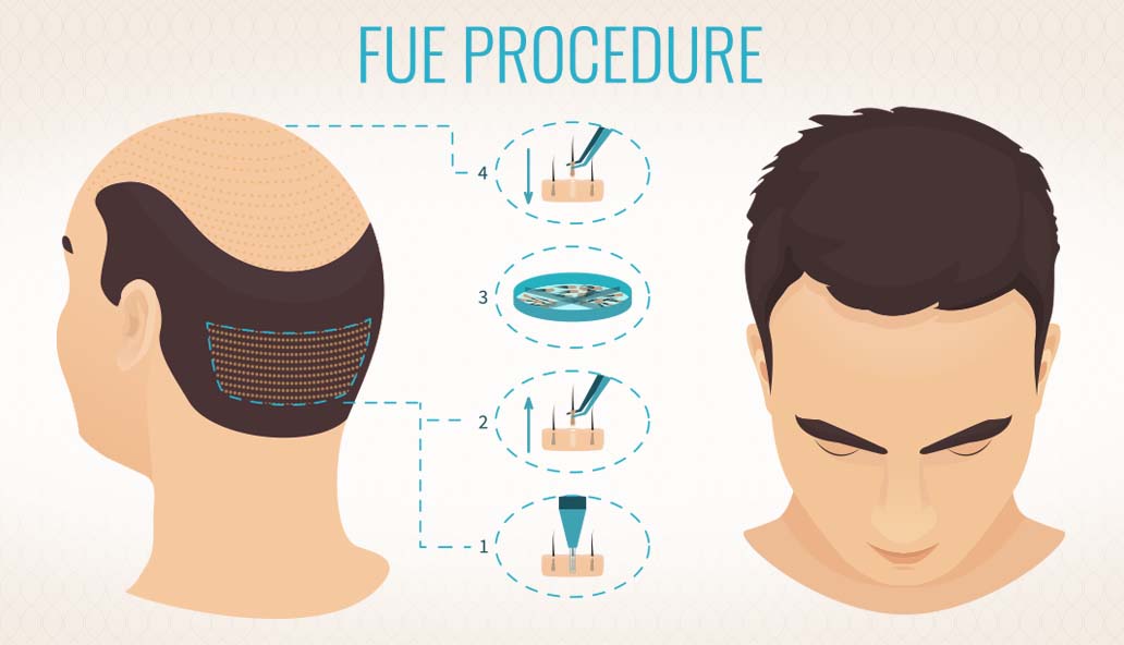 hair loss treatment
