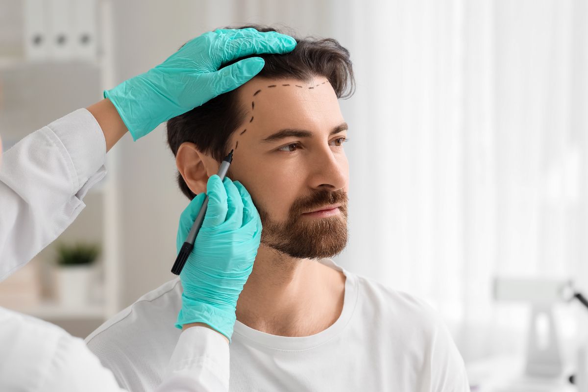 FUE Hair Transplant