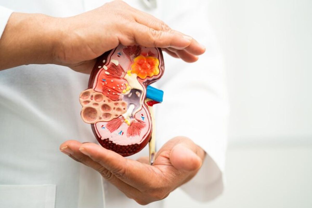 Kidney Transplant