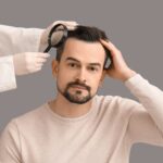 Hair Transplant