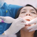 Teeth Scaling and Polishing